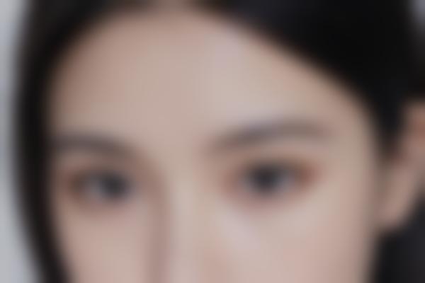 选择陈艳医生做整形的理由