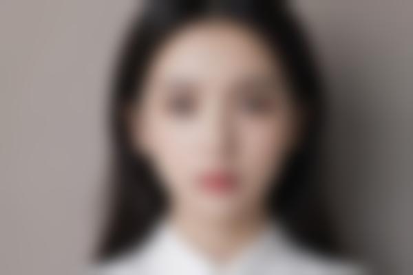 2、陈艳医生技术精细创伤小