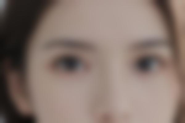 李婷整形项目价格参考