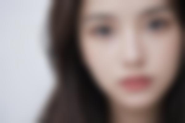 北京紫洁俪方春燕医生眼部整形好，春燕双眼皮手术自然无痕价格亲民！