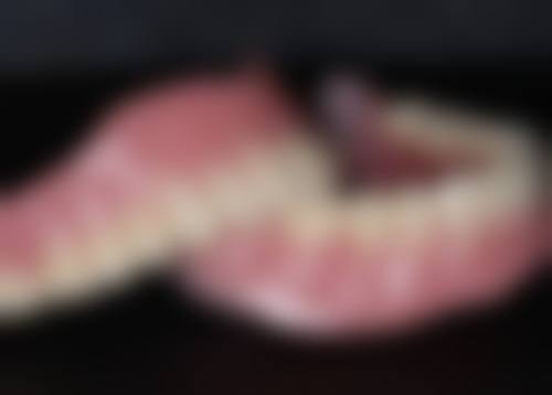 韩国种植牙价格