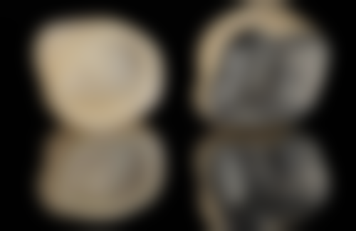 北京中诺口腔医院收费价格表/收费标准