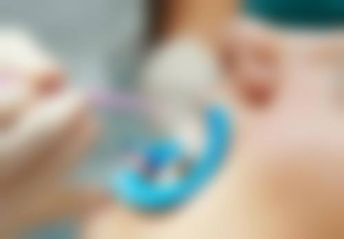 国内种牙省钱攻略