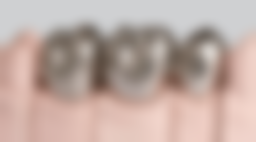 补牙与拔牙项目情况