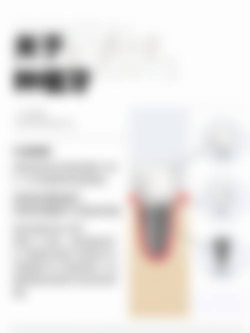 中南口腔唐青砖医生，全口种植实力如何？