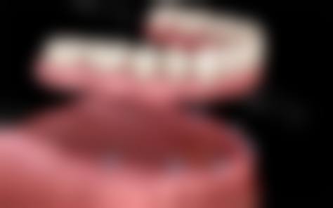 永州全口种植，选择医院要注意啥？