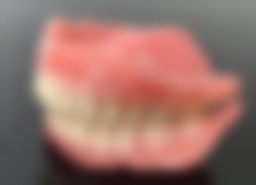 正常情况：杀完神经后取神经微痛奥秘