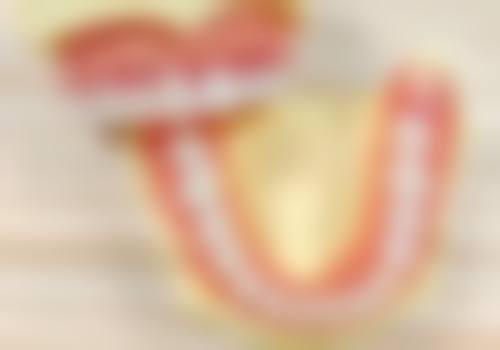 常见误区澄清要重视