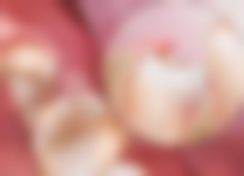 根管治疗的费用与风险：全方面了解