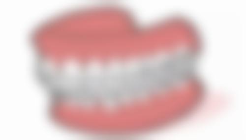 成人地包天纠正的成效与注意事项