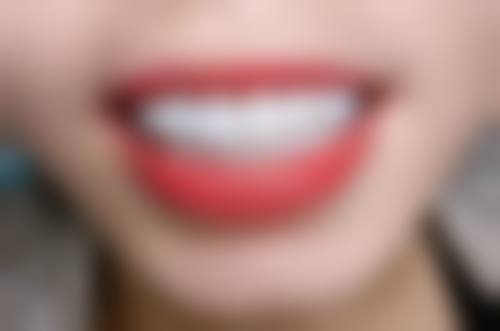 家庭美白：日常便捷的辅助之策