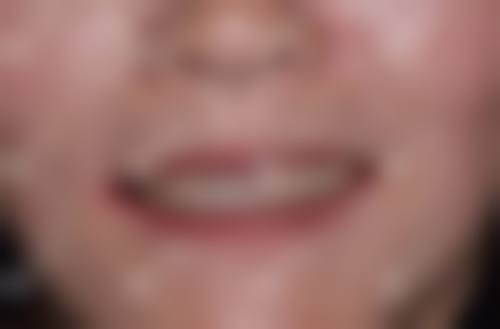 贴心服务体验，让看牙不再是难事