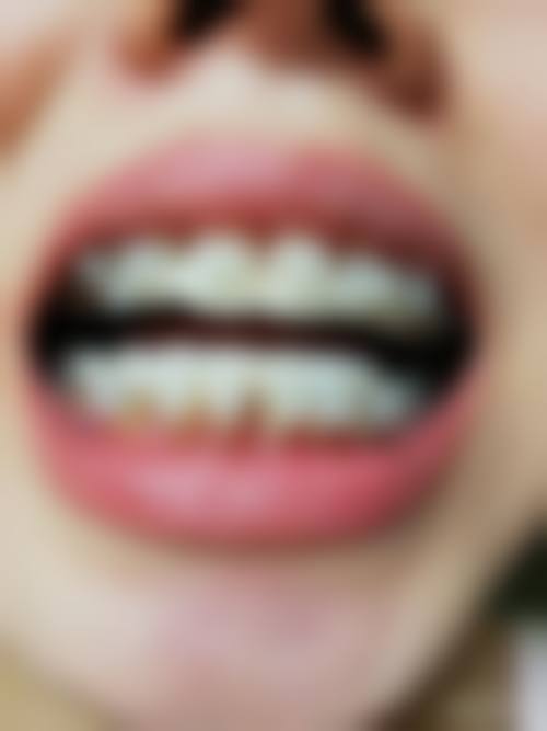 四、杭州临平贝佳康口腔门诊部特色项目及技术优势