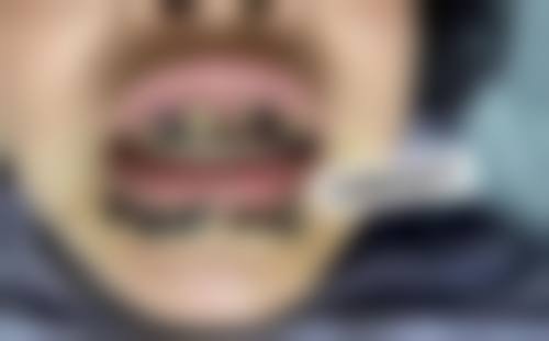 八、南昌唯乐口腔（红谷滩万达分院）预约挂号方式及流程