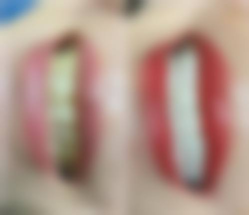 七、山东泰安大志口腔预约挂号方式及流程