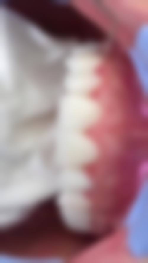 邵红兵医生真人实例