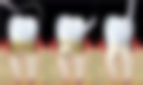 其他因素：医生与患者配合影响时间