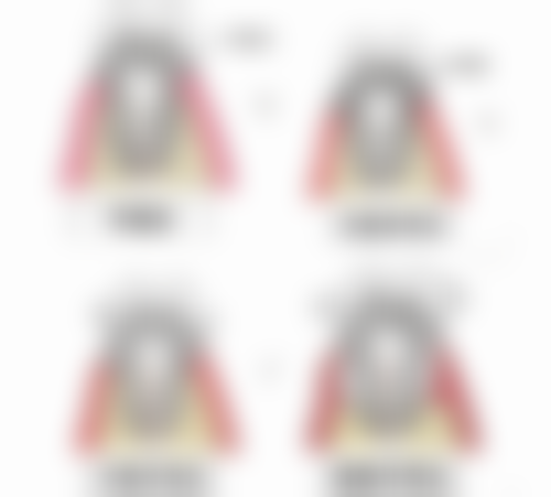 多普勒：超短种植体的特色之选