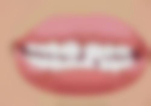 植是道：简单植入理念的践行者