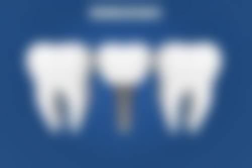 根管治疗小孩子能做吗？能！符合适应证就能做，还能医保报销，保留乳牙助恒牙萌出 