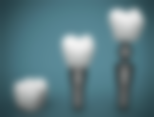 补牙材质选择注意事项：综合考量