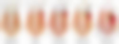 七、深圳美德口腔门诊部口碑怎么样？