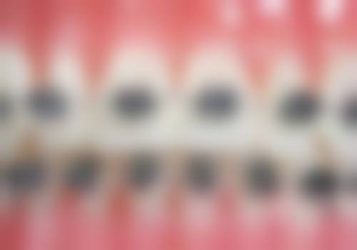 乳牙萌出管理：关注乳牙生长，预防地包天加重