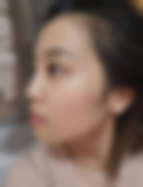 四、宁波海曙壹秒医疗美容诊所特色项目及技术优势