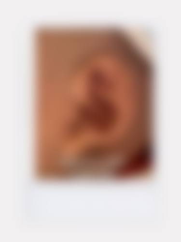 六、深圳深美医疗美容诊所收费价格表