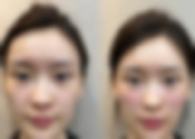 六、钦州槎城华美医疗美容诊所口碑怎么样？