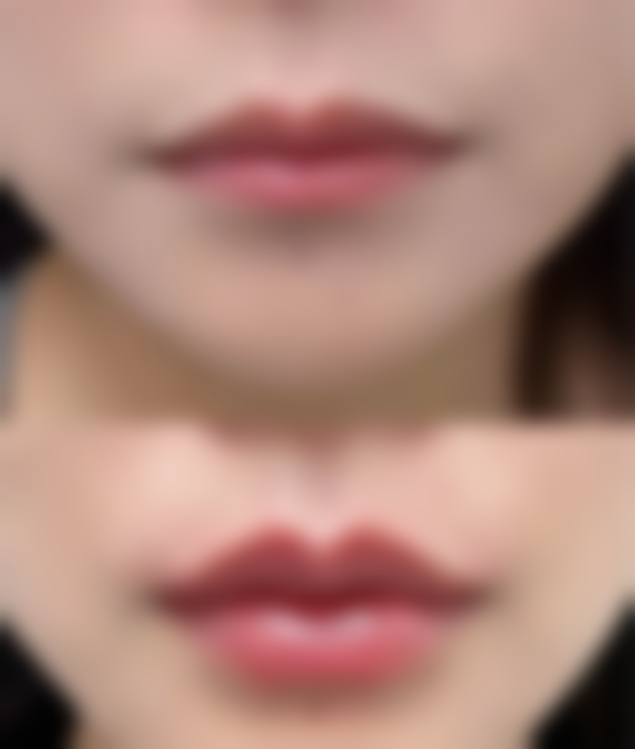 四、佛山古嘉强美嘉美整形医院特色项目及技术优势