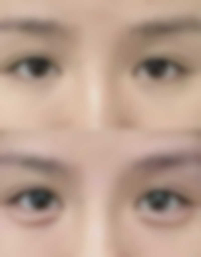 七、深圳深美医疗美容诊所口碑怎么样