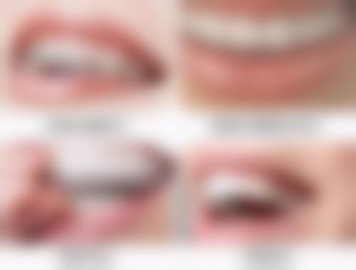 医院洗牙：专精保护与多种方法选择