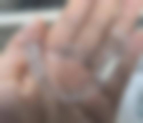 补牙可以用合作医疗报销吗？答案是看情况！基础补牙在定点机构或能报，比例30%-80% 