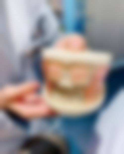 义齿相关问题解答