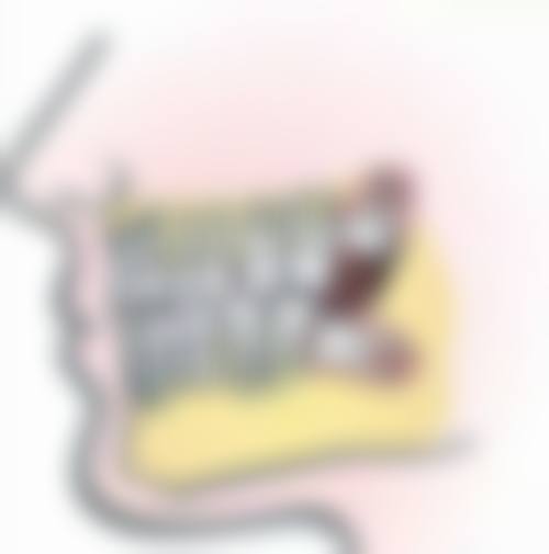 检查部位差异：影响烤瓷牙核磁共振兼容性