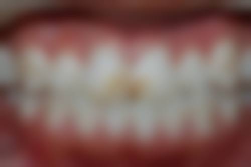 患者配合与治疗次数的关联