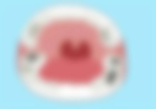 及时评估：侧穿情况究竟有多重度