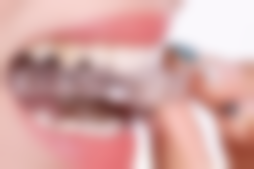 年龄不是问题，口腔骨量才是关键！