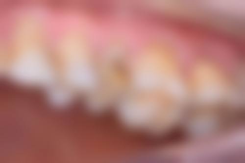 正睿齿科连锁 - 美冠口腔：老牌实力连锁