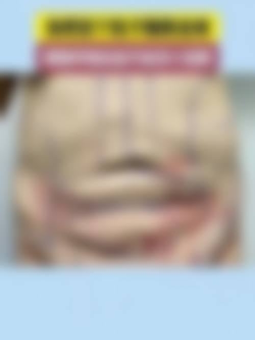 五、丹东雷雅华医疗美容收费价格表