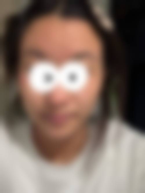 四、兴义刘德欣医疗美容诊所特色项目及技术优势