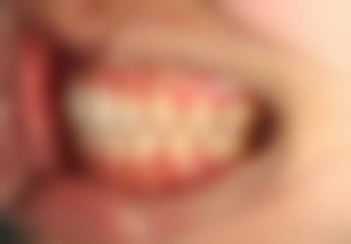 蒙自红河博爱医院口腔科正规靠谱吗？资质有证可查，江田坐诊支持社保