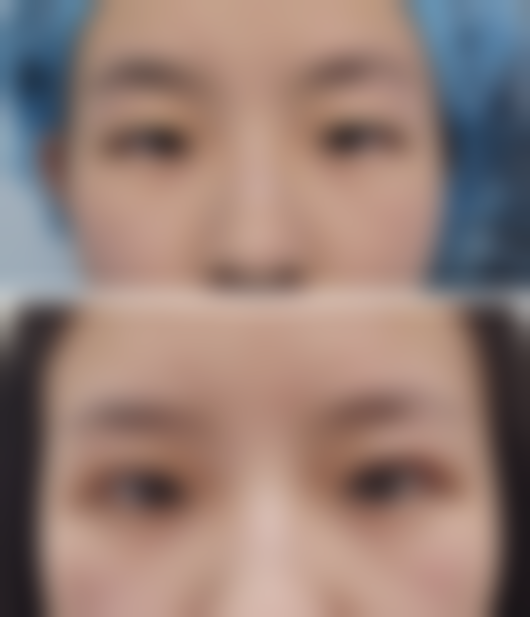 二、潜江白衣天使医疗整形医院是正规医院吗