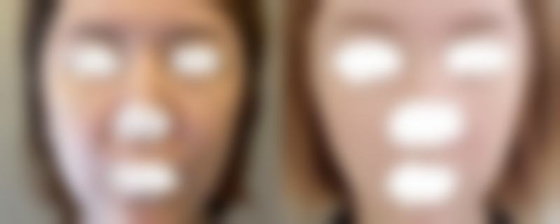 五、杭州医嘉怡医疗美容诊所收费价格表