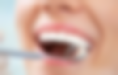 乳牙根管治疗后的注意事项与护理要点