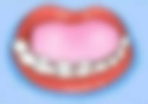 适用场景：金属牙与全瓷牙该怎么选