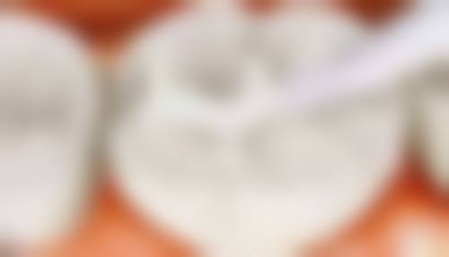 显微根管治疗的优势