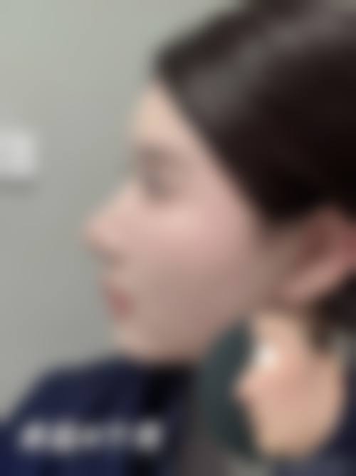 四、东港挚颜整形医院特色项目及技术优势