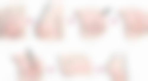 五、东港挚颜整形医院收费价格表